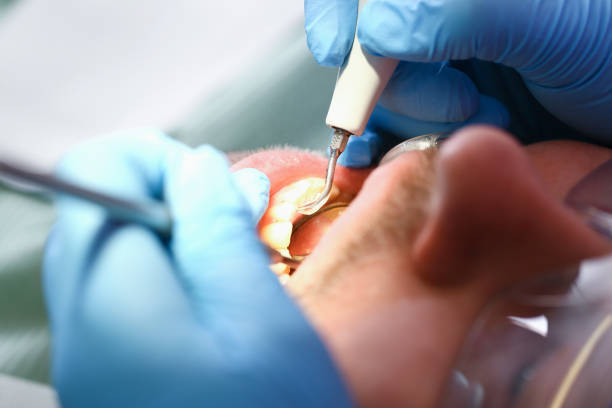 Best Emergency Care for Gum Disease in Decherd, TN