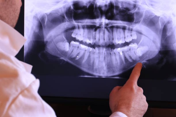 Best Dental Abscess Treatment in Decherd, TN